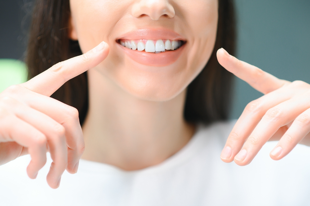 Bright Smile Results, San Diego Periodontal Care Woman pointing to her bright smile after seeing a periodontist in the San Diego community
