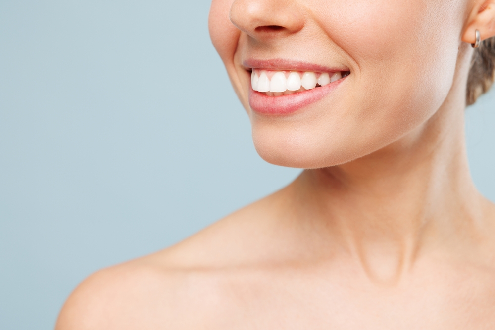 Close-up of a woman's bright, straight smile, an example of cosmetic dentistry results in La Jolla 
