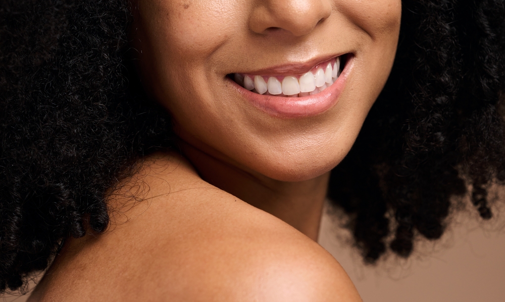 Radiant Smile: A Veneers Treatment Goal in the San Diego Community Close-up of a woman's radiant smile and white teeth, the kind of result veneers can help patients in the San Diego community achieve