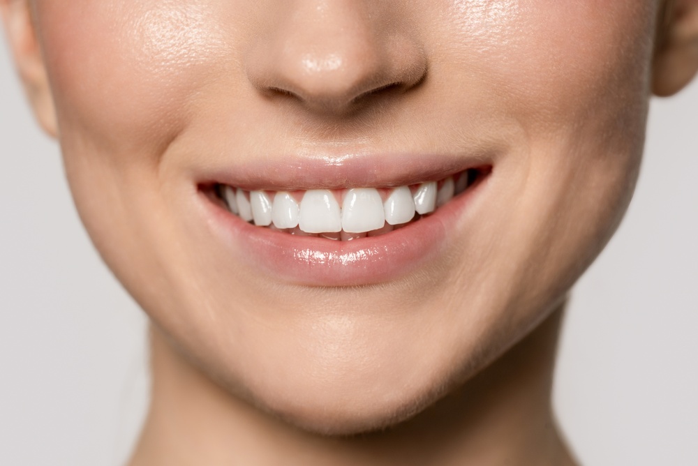Healthy Smile: A Goal of Periodontal Treatment in the San Diego Community Close-up of a woman's healthy smile with white teeth and pink gums, the kind of result periodontal treatment can help patients in the San Diego community achieve